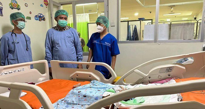 Usai Operasi Pemisahan, Bayi Kembar Siam Sudah Lewati Masa Kritis