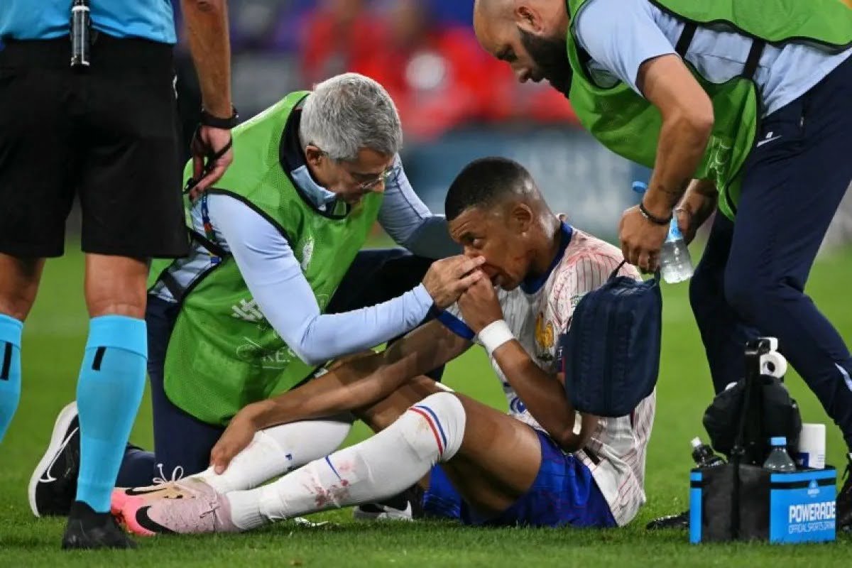 Mbappe Cedera Hidung, Nggak Halangin Laga Panas Prancis vs Belanda
